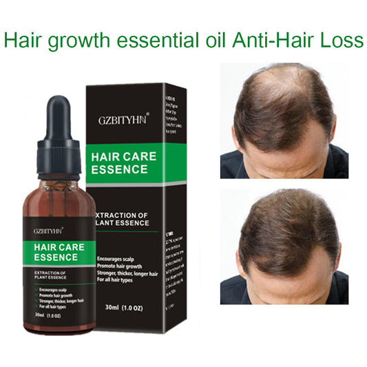 Natural Hair Growth Oil – Nourishing Essential Oil for Scalp Health and Hair Strengthening